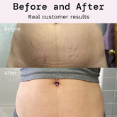 Rosarden Stretch Mark Prevention Cream for Pregnancy, Stretch Mark Cream Remover, Stretch Mark Lotion for Pregnancy, Tummy Butter for Stretch Marks Pregnancy, Shea Butter Stretch Mark Removal Cream
